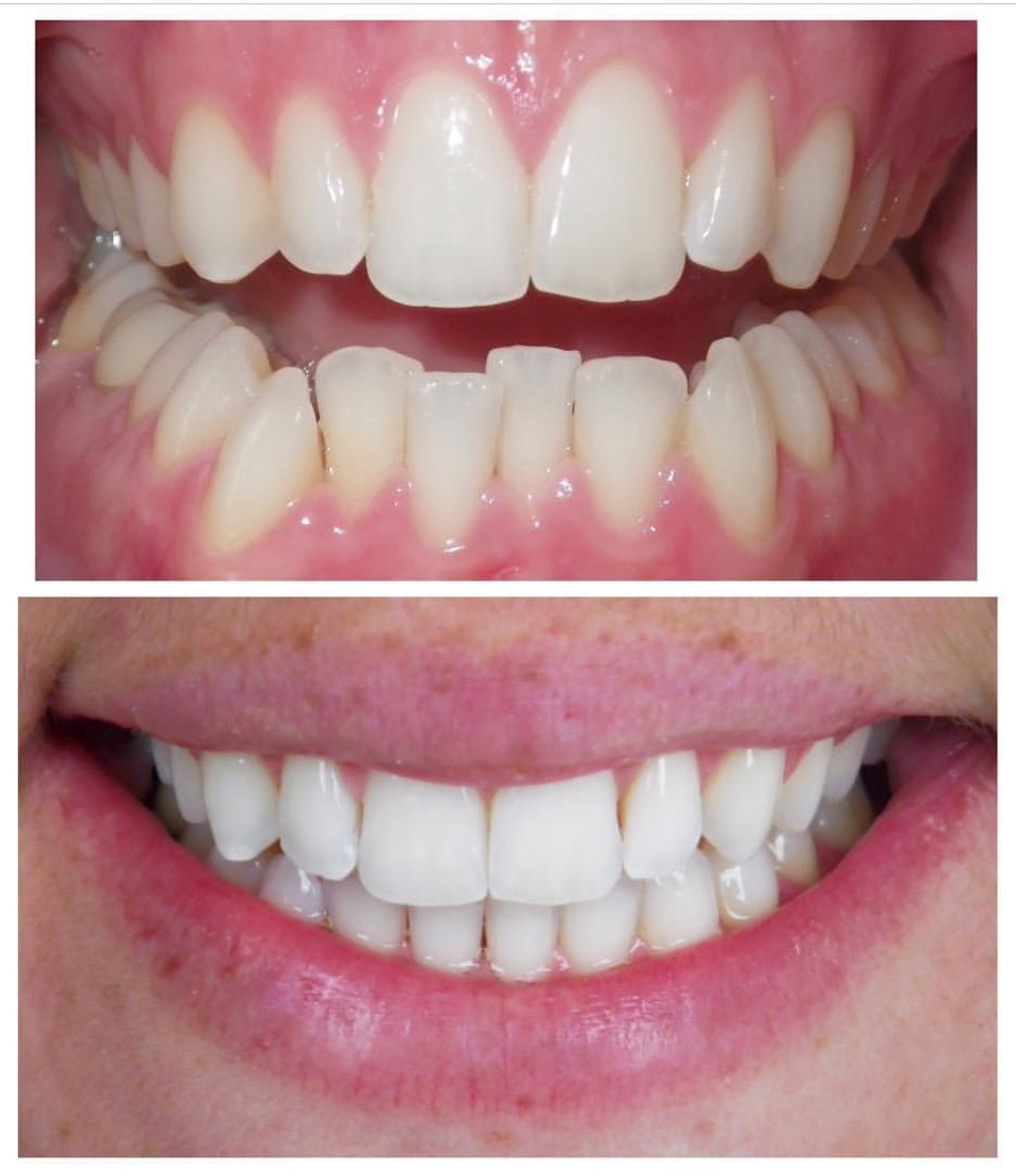 La Jolla Cosmetic Dentist