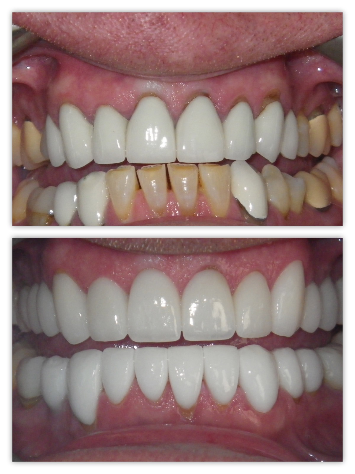 La Jolla Cosmetic Dentist