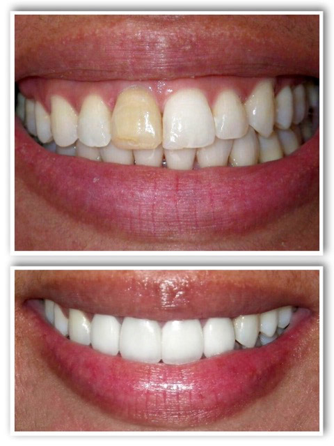 Cosmetic Dentist in La Jolla