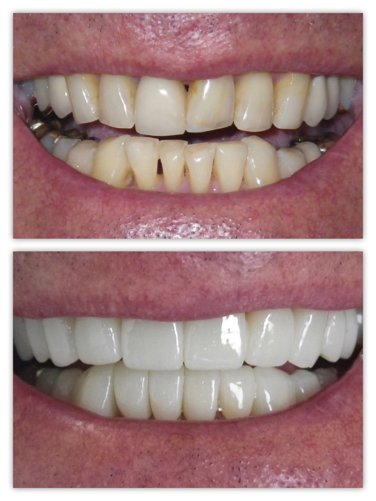 La Jolla Cosmetic Dentist
