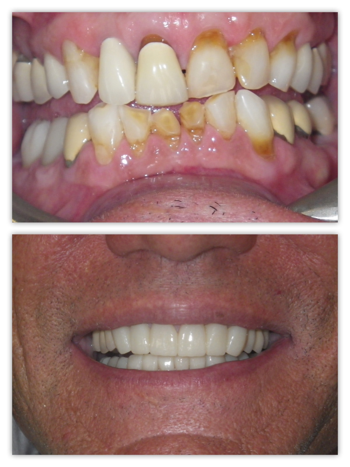 La Jolla Cosmetic Dentist